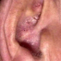 earpeeledbro